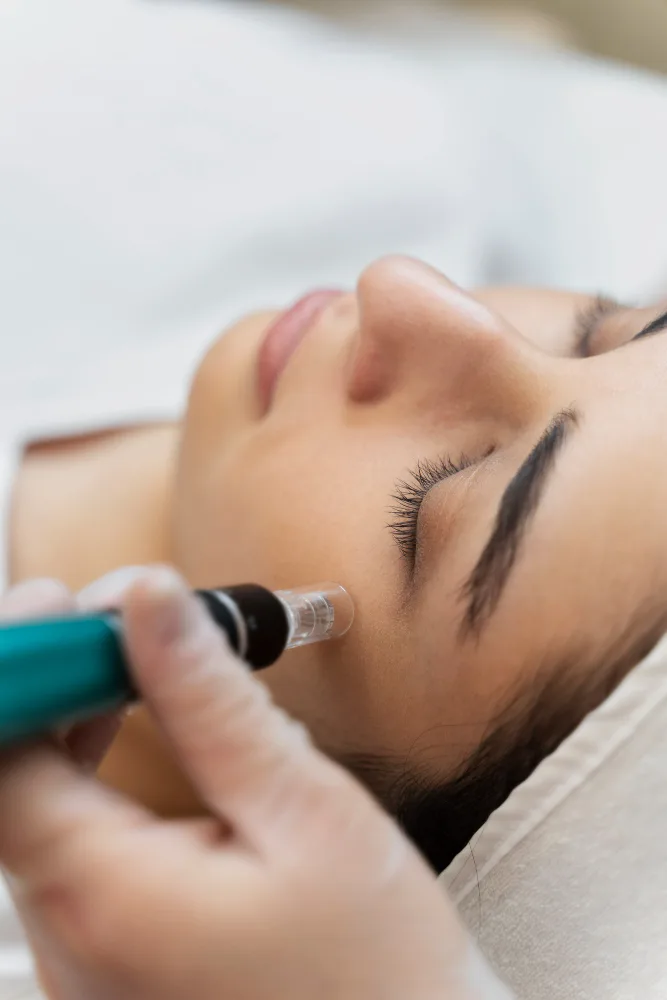 Dermapen – mikrojehličkové ošetření pleti